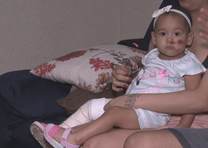 Bebê atropelada na saída de casa, no DF, se salva sem ferimentos graves; VEJA VÍDEO